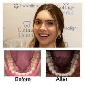 Zianya: "Had the best Invisalign experience with CD!"