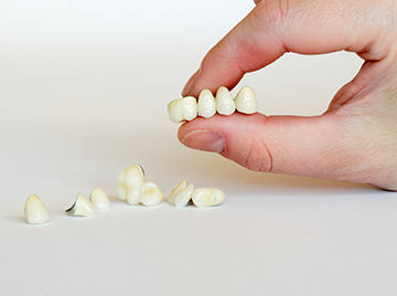 Dental-Crowns-and-Oral-Health-How-They-Protect-and-Strengthen-Your-Smile
