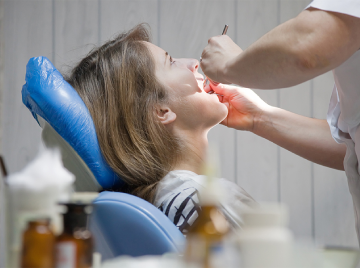 How Dental Sealants Protect Teeth from Decay