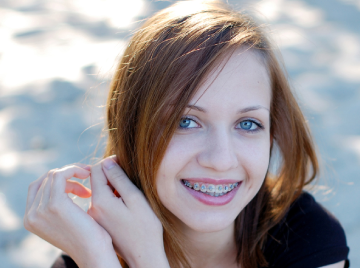 How to Fix One Crooked Tooth Without Braces