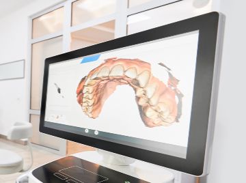 The Role of Your General Dentist in Long-Term Oral Cancer Prevention